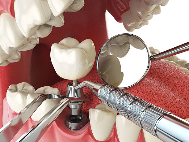Best Emergency Treatment for Oral Infections in Inez, TX